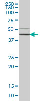 HORMAD1 antibody (ab57883) at 1ug/lane + HepG2 cell lysate at 25ug/lane.