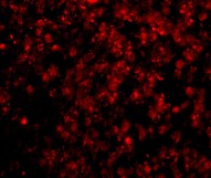 Immunofluorescence of Lipe in Human Lymph Node cells using ab45422 at 20 ug/ml.