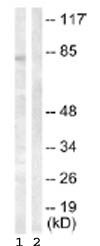 All lanes : Anti-Hormone sensitive lipase antibody (ab63492) at 1/500 dilutionLane 1 : extracts from Jurkat cells, treated with Calyculin A (100nM, 30mins)Lane 2 : extracts from Jurkat cells, treated with Calyculin A (100nM, 30mins) with blocking peptide at 5 µgLysates/proteins at 5 µg per lane.