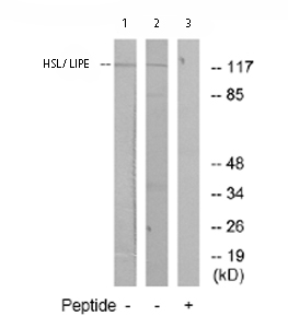 All lanes : Anti-Hormone sensitive lipase antibody (ab73736) at 1/500 dilutionLane 1 : Extracts from Jurkat cellsLane 2 : Extracts from MCF-7 cellsLane 3 : Extracts from Jurkat cells plus 10µg immunizing peptideLysates/proteins at 30 µg per lane.