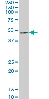 Anti-HOXA5 antibody (ab55239) + Human skeletal muscleObserved band size : 49 kDa (why is the actual band size different from the predicted?)