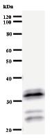 Anti-HOXA9 antibody [HOX5I043] (ab51236)