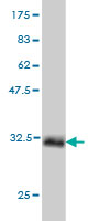 Western blot against tagged recombinant protein immunogen using ab55242 HOXB1 antibody at 1ug/ml.