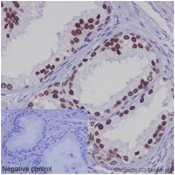 Immunohistochemical analysis of paraffin-embedded Human prostatic hyperplasia tissue labeling HOXB13 using ab192872 at 1/750 dilution (2 μg/ml). A prediluted HRP Polymer for Rabbit IgG was used as the secondary antibody. Counterstain: Hematoxylin. Negative control also shown.