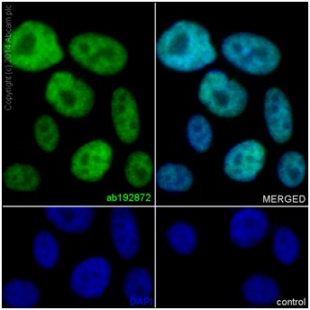 Immunofluorescence analysis of PC3 cells labeling HOXB13 using ab192872 at 1/700 dilution (5 μg/ml). A Goat anti rabbit IgG (Alexa Fluor®488) at 1/400 dilution (ab150077) was used as the secondary antibody. Cells were fixed with 4% paraformaldehyde and permealized with 0.1% triton X-100. Counterstain: DAPI.