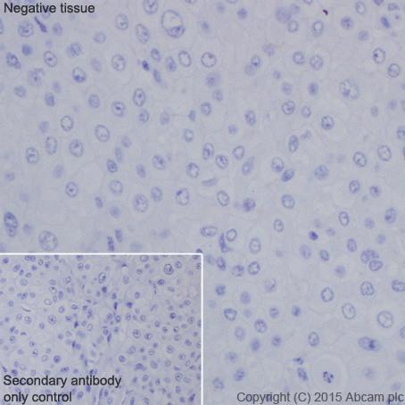 Immunohistochemical analysis of paraffin-embedded Human transitional cell carcinoma of bladder tissue labeling HOXB13 with ab201682 at 1/3000 dilution, followed by Goat Anti-Rabbit IgG H&L (HRP) (ab97051) secondary antibody at 1/500 dilution. Human transitional cell carcinoma of bladder represents a HOXB13 negative tissue. Counter stained with Hematoxylin.Secondary antibody only control: Used PBS instead of primary antibody, secondary antibody is Goat Anti-Rabbit IgG H&L (HRP) (ab97051) at 1/500 dilution.