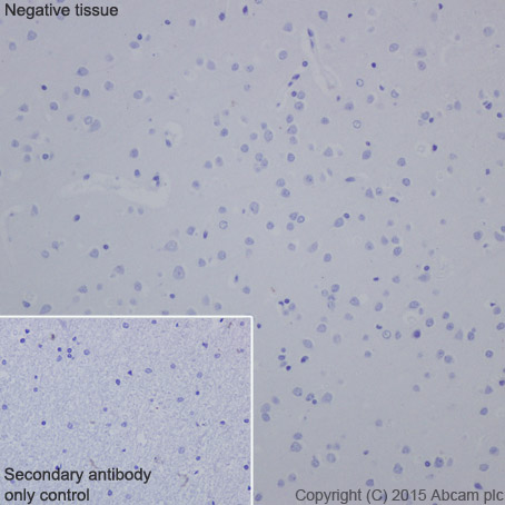 Immunohistochemical analysis of paraffin-embedded Human cerebral cortex tissue labeling HOXB13 with ab201682 at 1/3000 dilution, followed by Goat Anti-Rabbit IgG H&L (HRP) (ab97051) secondary antibody at 1/500 dilution. Human cerebral cortex represents a HOXB13 negative tissue. Counter stained with Hematoxylin.Secondary antibody only control: Used PBS instead of primary antibody, secondary antibody is Goat Anti-Rabbit IgG H&L (HRP) (ab97051) at 1/500 dilution.