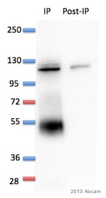 ab155539 immunoprecipitating HGS in human hTERT-RPE1 whole cell lysate. Cell lysate from 4000000 cells was incubated with primary antibody (1/500 in triton 1% buffer) for 12 hours at 4°C. Western blotting confirmed successful immunoprecipation. Lower 50kDa band corresponds to IgG.See Abreview