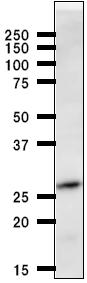 Anti-HOXB7 antibody [747C4a] (ab51237) at 1/50 dilution + A2058 whole cell lysate at 50 µgSecondaryMouse IgG antibody at 1/2500 dilution