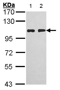 All lanes : Anti-HGS antibody - C-terminal (ab155539) at 1/10000 dilutionLane 1 : H1299 whole cell lysateLane 2 : HeLa whole cell lysateLysates/proteins at 30 µg per lane.