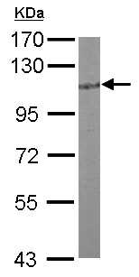 Anti-HGS antibody - C-terminal (ab155539) at 1/1000 dilution + Mouse brain whole cell lysate at 50 µg