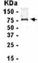 Anti-HOXC11 antibody (ab37844) + E. coli derived fusion protein at 2.5 µgSecondaryGoat anti IgY HRP at 1/1000.