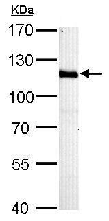 Anti-HGS antibody - C-terminal (ab155539) at 1/1000 dilution + Rat brain whole cell lysate at 50 µg