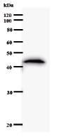 Anti-HOXC11 antibody [HOX5J232] (ab51238)