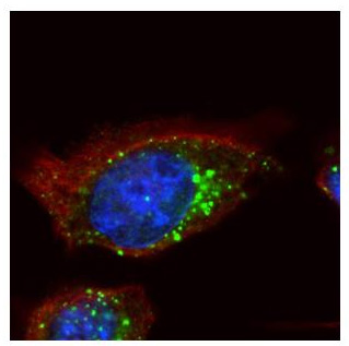 Confocal immunofluorescence analysis of methanol-fixed A431 cells, labeling HGS with ab155539 at 1/200 dilution (green) and Alpha-tubulin filaments (red).