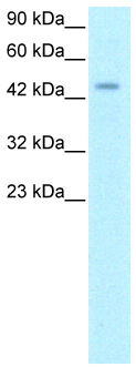 Anti-HOXD3 antibody (ab22840) at 1 µg/ml + Jurkat cell lysate.SecondaryHRP conjugated anti-Rabbit IgG should be diluted in 1/50,000 - 100,000developed using the ECL techniquePerformed under reducing conditions.
