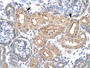 ab22840, at a 1/125-250 dilution, staining human HOXD3 in human kidney by Immunohistochemistry, Paraffin embedded tissue. Positive labeled cells, marked with arrows, are epithelial cells of Renal Tubule. Magnification 400 x.