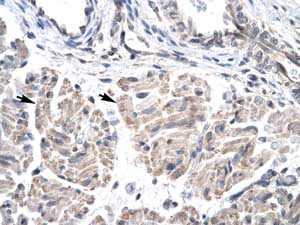 ab22840, at a 1/125-250 dilution, staining human HOXD3 in human muscle by Immunohistochemistry, Paraffin embedded tissue. Positive labeled cells, marked with arrows, are skeletal muscle cells. Magnification 400 x.