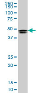 Anti-HOXD3 antibody (ab76970) at 5 µg/ml + Hela nuclear extract at 25 µgSecondaryGoat anti-mouse IgG (H&L)-HRP conjugate at 1/2500 dilution