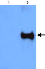 All lanes : Anti-HPS6 antibody (ab22149) at 1/1000 dilutionLane 1 : Total protein extract from E. coli with ~50ng to 100ng of a negative control fusion protein with an irrelevant antigen at 20 ugLane 2 : Total protein extract from E. coli with ~50ng to 500ng of the antigen fusion protein at 20 ug SecondaryRabbit anti-mouse IgG + IgM, (H+L) horseradish peroxidase conjugated at 1/5000 dilution