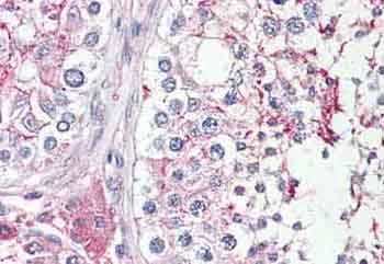 Immunohistochemical analysis of Formalin-fixed, Paraffin-embedded Human Testis tissue labelling HRAS like suppressor with ab134828 at 3.75 µg/ml.