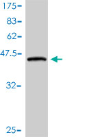 Western blot against tagged recombinant protein immunogen using ab56774 HRASLS3 antibody at 1ug/ml.