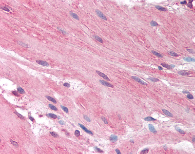 Immunohistochemistry analysis of formalin fixed, paraffin embedded small intestine smooth muscle tissue using 2.5 &microg/ml ab78224.