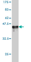 Western blot against tagged recombinant protein immunogen using ab55725 hHR23A antibody at 1ug/ml. 