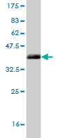 Western blot against tagged recombinant protein immunogen using ab57254 HERC4 antibody at 1ug/ml.