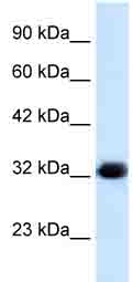 Anti-HS747E2A antibody (ab28738) at 1.25 µg/ml + HepG2 cell lysate at 10 µgSecondaryHRP conjugated anti Rabbit IgGObserved band size : 33 kDa (why is the actual band size different from the predicted?)