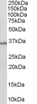 Anti-HSD11B1 antibody (ab27501) at 0.3 µg/ml + Human Liver lysate (35 µg protein in RIPA buffer).developed using the ECL technique