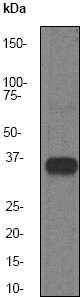Anti-HSD17B1 antibody [EP1682Y] (ab51045) at 1/100000 dilution + Human placenta lysate at 10 µgSecondaryGoat anti-Rabbit HRP labeled. at 1/2000 dilution