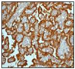 Ab51045 (1/100 dilution) staining human HSD17B1 in paraffin embedded human placenta tissue by Immunohistochemistry.