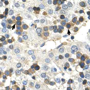 Immunohistochemistry (Formalin/PFA-fixed paraffin-embedded sections) analysis of human liver tissue labelling HSD17B6 with ab62221 at 4-8µg/ml. Arrows indicate positively labelled hemopoietic cells. Magnification: 400X.