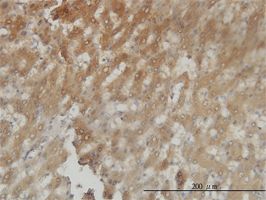 HSD3a antibody (ab54606) used in immunohistochemistry at 3ug/ml on formalin fixed and paraffin embedded human liver tissue.