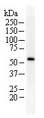 Anti-hHR23b antibody [2857D7a] (ab70602) at 0.2 µg/ml + Whole cell lysate from HeLa cells at 25 µg