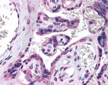 ab69807, at 1:1000 dilution, staining human HSD3B1 in placental villi by Immunohistochemistry (Formalin/PFA-fixed paraffin-embedded sections).