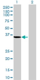 All lanes : Anti-HSDL1 antibody (ab69524) at 1/500 dilutionLane 1 : HSDL1 transfected 293T cell lysateLane 2 : Non-transfected 293T cell lysateLysates/proteins at 25 µg per lane.SecondaryGoat anti-mouse IgG (H&L)-HRP conjugate at 1/2500 dilution