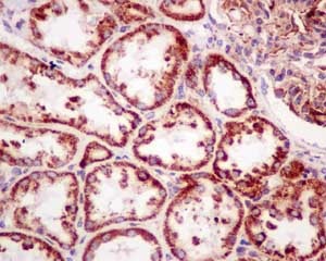 Immunohistochemical analysis of paraffin-embedded Human kidney tissue labeling HSDL2 using ab181174 at a 1/100 dilution using prediluted HRP Polymer for Rabbit IgG secondary antibody and counterstained with Hematoxylin.
