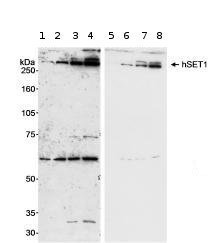 Lanes 1 - 4 :  Anti-hSET1 antibody (ab70379) at 1 µg/mlLanes 5 - 8 :  Anti-hSET1 antibody (ab70379) at 0.2 µg/mlLane 1 : 293T whole cell lysate at 100 µgLane 2 : 293T whole cell lysate at 200 µgLane 3 : 293T nuclear lysate at 100 µgLane 4 : 293T nuclear lysate at 200 µgLane 5 : 293T whole cell lysate at 100 µgLane 6 : 293T whole cell lysate at 200 µgLane 7 : 293T nuclear lysate at 100 µgLane 8 : 293T nuclear lysate at 200 µgdeveloped using the ECL technique
