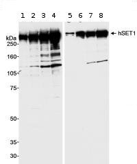Lanes 1 - 4 :  Anti-hSET1 antibody - ChIP Grade (ab70378) at 1 µg/mlLanes 5 - 8 :  Anti-hSET1 antibody - ChIP Grade (ab70378) at 0.2 µg/mlLane 1 : 293T whole cell lysate at 100 µgLane 2 : 293T whole cell lysate at 200 µgLane 3 : 293T nuclear extract at 100 µgLane 4 : 293T nuclear extract at 200 µgLane 5 : 293T whole cell lysate at 100 µgLane 6 : 293T whole cell lysate at 200 µgLane 7 : 293T nuclear extract at 100 µgLane 8 : 293T nuclear extract at 200 µgdeveloped using the ECL technique