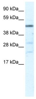 Anti-HSFY1 antibody (ab33057) at 5 µg/ml (in 5% skim milk / PBS buffer) + fetal liver lysate at 10 µgSecondaryHRP conjugated anti-Rabbit IgG at 1/50000 dilution