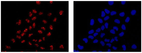 Immunofluorescent analysis of 4% paraformaldehyde-fixed HeLa cells labeling Hsp20 with ab188864 at 1/500 dilution followed by Goat anti rabbit IgG (Alexa Fluor® 555) secondary antibody at 1/200 dilution. Counter stained with Dapi (blue).