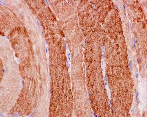 Immunohistochemical analysis of paraffin-embedded Human skeletal muscle tissue labeling Hsp20 with ab184161 at 1/250 dilution followed by prediluted HRP Polymer for Rabbit IgG. Counter stained with hematoxylin.