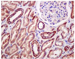 Immunohistochemical analysis of paraffin embedded Human kidney tissue labeling HIBADH with ab175203 at 1/50 dilution.