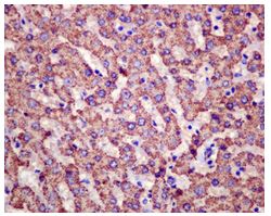Immunohistochemical analysis of paraffin embedded Human liver tissue labeling HIBADH with ab175203 at 1/50 dilution.