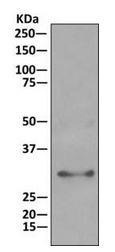 Western blot analysis on immunoprecipitation pellet from HepG2 cell lysate labeling HIBADH with ab175203 at 1/10 dilution.