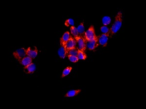 Immunofluorescent analysis of HepG2 cells labeling HIBADH with ab172955 at 1/250 dilution.
