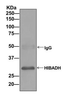 Western blot analysis on immunoprecipitation pellet from HepG2 cell lysate using ab172955 at a 1/100 dilution.