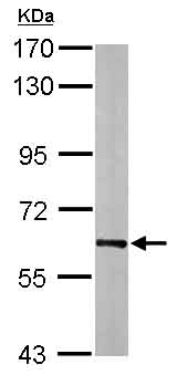 Anti-Hsp60 antibody (ab137706) at 1/20000 dilution + Mouse brain whole cell lysate at 30 µg
